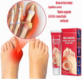 Crema para aliviar las molestias de los juanetes